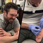 Coughing and Dry Needling
