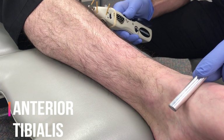 How Does Physical Therapy Dry Needling With Electrical Stimulation Improve  Symptoms? - Mend Colorado