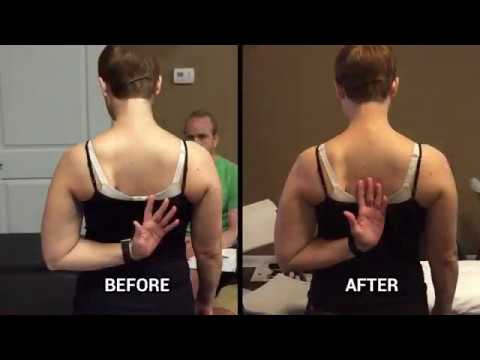 shoulder medial rotation