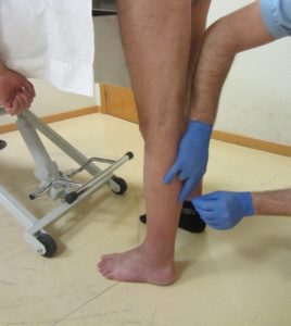 Dry needling the calf muscle in a pre-stretched position