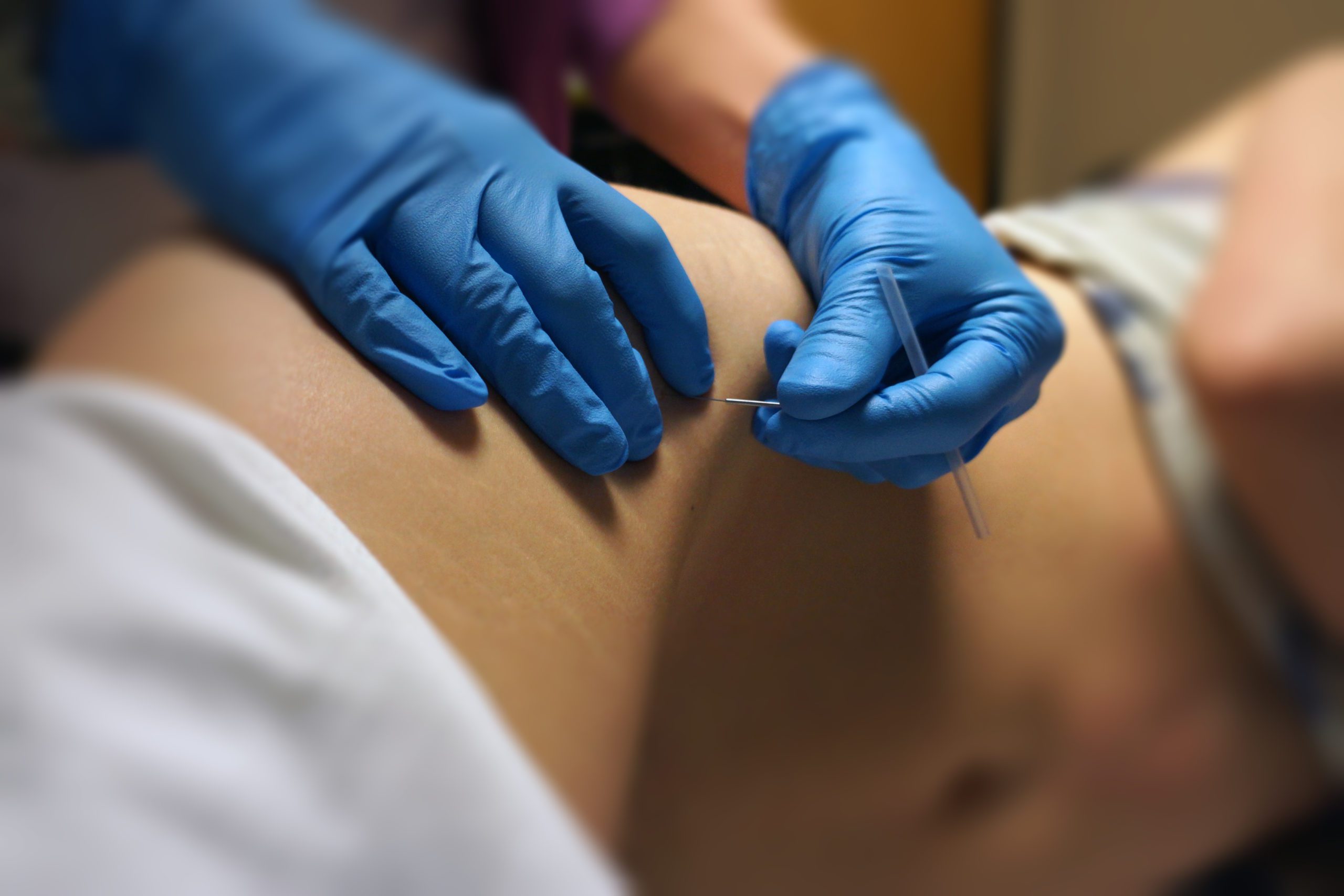 Person with gloves performing pelvic dry needling