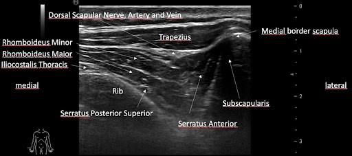 Location of the serratus superior posterior muscle scan image