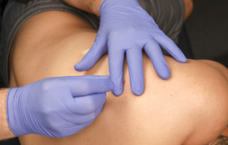 Dry needling: An innovative tool in treating pelvic-related conditions