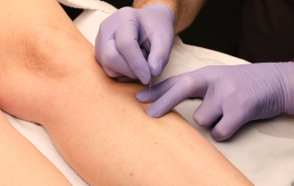 Dry needling: An innovative tool in treating pelvic-related conditions